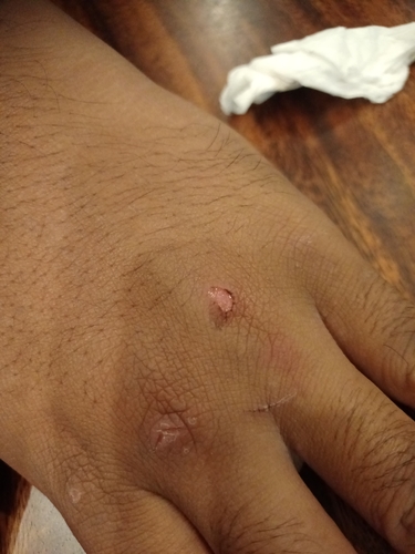 Gluta renghas